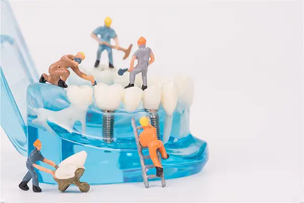 A miniature team of toy construction workers conduct repairs on a transparent dental model with a dental implant bridge at Coastal Maine Oral & Maxillofacial Surgery in Scarborough, ME