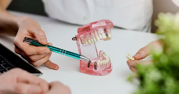 Dentist using a pink dental model to explain how a dental bridge works, pointing to the implant-supported teeth.